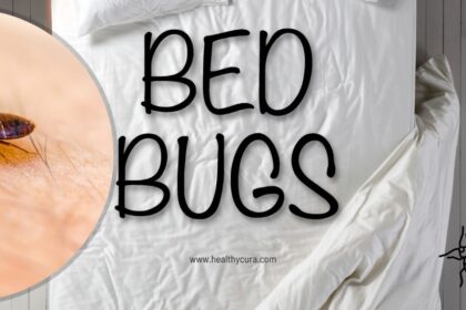 Everything You Need to Know About Bed Bug Bites Healthy Cura