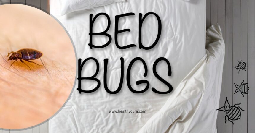 Everything You Need to Know About Bed Bug Bites Healthy Cura