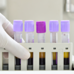 Understanding MCV In Blood Tests What Does It Mean