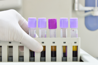 Understanding MCV In Blood Tests What Does It Mean