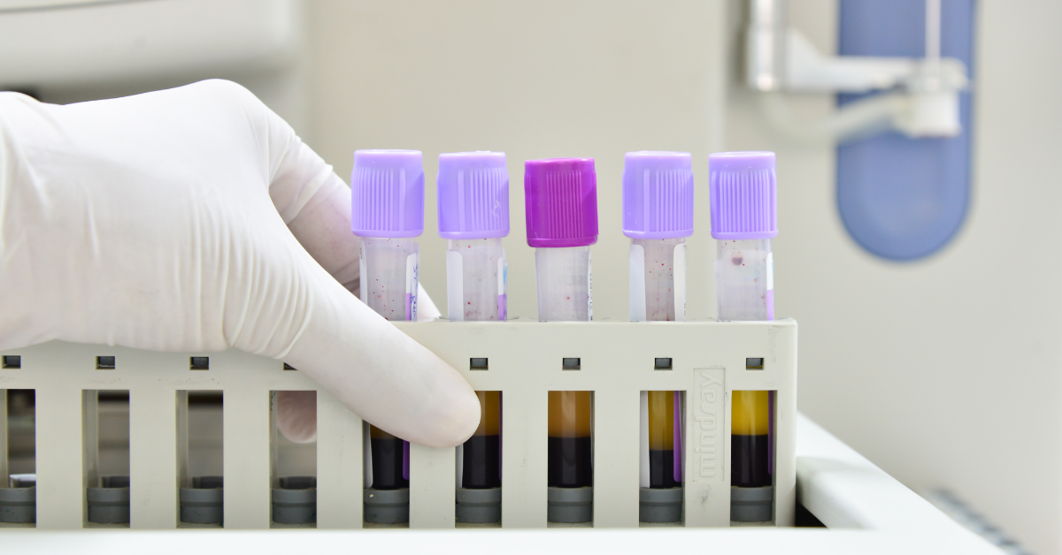 Understanding MCV In Blood Tests What Does It Mean